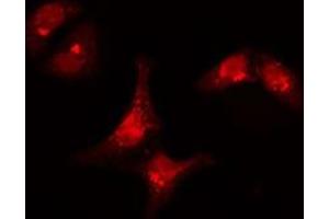 ABIN6277308 staining  Hela cells by IF/ICC. (KRT15 Antikörper  (N-Term))