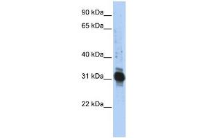 WB Suggested Anti-ZFAND3 Antibody Titration:  0. (ZFAND3 Antikörper  (Middle Region))