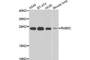 Western blot analysis of extracts of various cell lines, using RAB5C antibody (ABIN5975504) at 1/1000 dilution. (Rab5c Antikörper)