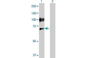 Western Blot analysis of SELE expression in transfected 293T cell line by SELE MaxPab polyclonal antibody. (Selectin E/CD62e Antikörper  (AA 1-610))