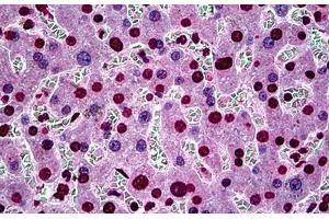 Human Liver: Formalin-Fixed, Paraffin-Embedded (FFPE) (SGK1 Antikörper  (AA 1-91))
