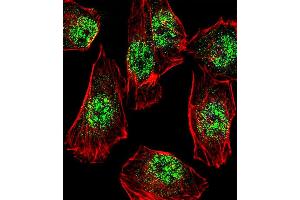 Fluorescent confocal image of A549 cell stained with RHOXF2B Antibody (Center) (ABIN1538705 and ABIN2838200). (RHOXF2B Antikörper  (AA 95-121))