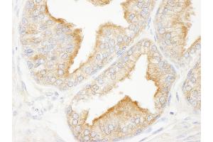 anti-KN Motif and Ankyrin Repeat Domains 2 (KANK2) (AA 550-600) antibody
