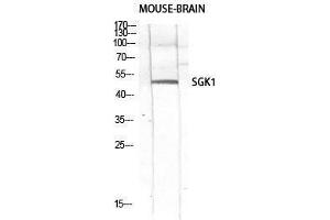 Western Blotting (WB) image for anti-serum/glucocorticoid Regulated Kinase 1 (SGK1) (Tyr1062) antibody (ABIN3186931) (SGK1 Antikörper  (Tyr1062))