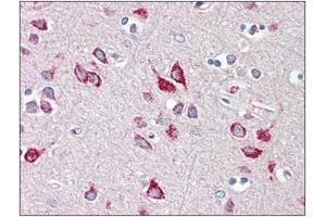Human Brain, Cortex: Formalin-Fixed, Paraffin-Embedded (FFPE) (HEXB Antikörper  (C-Term))