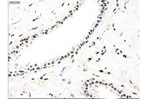 Immunohistochemical staining of paraffin-embedded breast tissue using anti-MAP2K4 mouse monoclonal antibody. (MAP2K4 Antikörper)