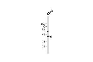 Western Blotting (WB) image for anti-Matrix Metallopeptidase 12 (Macrophage Elastase) (MMP12) (AA 391-420), (C-Term) antibody (ABIN390136)