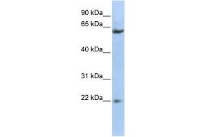 WB Suggested Anti-SUFU Antibody Titration:  0.