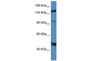 Western Blot showing MYPN antibody used at a concentration of 1. (Myopalladin Antikörper  (C-Term))
