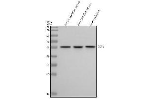 Western blot analysis of AKT3 using anti-AKT3 antibody (AZD9IL79).