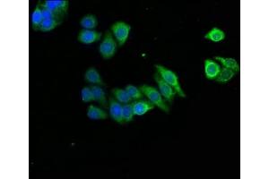 Immunofluorescence staining of HepG2 cells with ABIN7143681 at 1:166, counter-stained with DAPI.