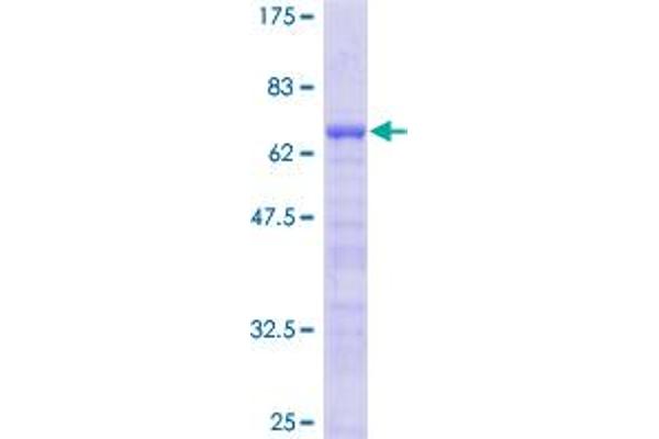 Leiomodin 1 Protein (LMOD1) (AA 1-269) (GST tag)