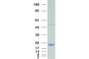 Western Blotting (WB) image for Dual Specificity Phosphatase 3 (DUSP3) protein (Myc-DYKDDDDK Tag) (ABIN2719836)
