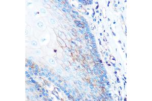 Immunohistochemistry of paraffin-embedded human esophageal using HLA-A Rabbit mAb (ABIN7268366) at dilution of 1:100 (40x lens).