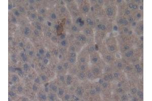 Immunohistochemistry (IHC) image for anti-Matrix Metallopeptidase 3 (Stromelysin 1, Progelatinase) (MMP3) (AA 278-450) antibody (ABIN7427282)