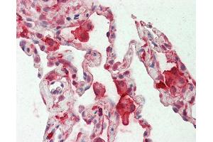 Anti-CAPG / MCP antibody IHC staining of human lung. (CAPG Antikörper  (AA 205-217))