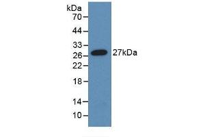 Detection of Recombinant ANGPTL1, Human using Monoclonal Antibody to Angiopoietin-3 (ANG-3) (Angiopoietin 4 Antikörper  (AA 271-491))