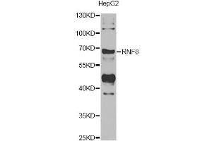 Western blot analysis of extracts of HepG2 cells, using RNF8 antibody (ABIN5974404) at 1/1000 dilution. (RNF8 Antikörper)