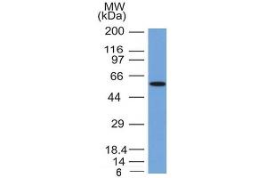 Western Blot Analysis of MCF-7 cell lysate with Occludin Mouse Monoclonal Antibody (OCLN/2181). (Occludin Antikörper  (AA 282-415))