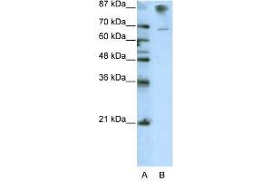 Western Blot showing HKR1 antibody used at a concentration of 1-2 ug/ml to detect its target protein.