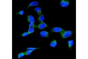 IF analysis of RAB7 using anti-RAB7 antibody (ABIN3044538).