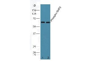 Mouse brain lysates probed with Rabbit Anti-PTPN11 (Tyr584) Polyclonal Antibody (ABIN745838) at 1:300 overnight in 4 °C. (PTPN11 Antikörper  (pTyr584))