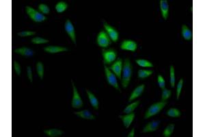 Immunofluorescence staining of Hela Cells with ABIN7127477 at 1:50, counter-stained with DAPI. (Rekombinanter ERK2 Antikörper)