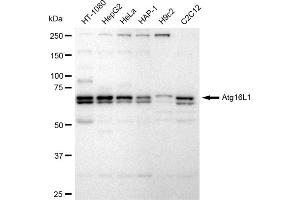 Western blotting analysis using Atg16L1 antibody (ABIN7797670). (Rekombinanter ATG16L1 Antikörper)