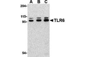 Western Blotting (WB) image for anti-Toll-Like Receptor 6 (TLR6) (Middle Region) antibody (ABIN1031130) (TLR6 Antikörper  (Middle Region))