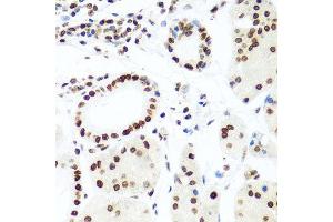 Immunohistochemistry of paraffin-embedded human gastric using H2AFX antibody at dilution of 1:100 (x40 lens). (H2AFX Antikörper)