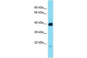 Western Blotting (WB) image for anti-Regulator of Chromosome Condensation (RCC1) and BTB (POZ) Domain Containing Protein 1 (RCBTB1) (N-Term) antibody (ABIN2790441)