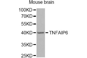 Western blot analysis of extracts of mouse brain, using TNFAIP6 Antibody (ABIN5975410) at 1/1000 dilution.