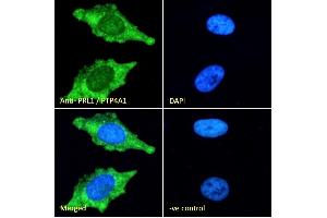 PTP4A1 Antikörper  (C-Term)