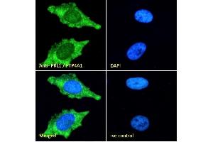 (ABIN185274) Immunofluorescence analysis of paraformaldehyde fixed HeLa cells, permeabilized with 0.