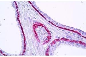 Anti-KRT15 / Cytokeratin 15 antibody IHC staining of human prostate, epithelium. (KRT15 Antikörper  (AA 1-50))