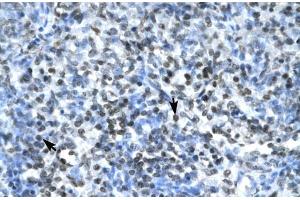 Human Spleen; CLDN17 antibody - middle region in Human Spleen cells using Immunohistochemistry (Claudin 17 Antikörper  (Middle Region))