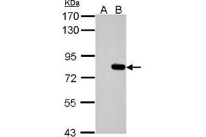 WB Image Sample (30 ug of whole cell lysate) A: Non-transfected 293T lysates B: hSLU7 transfected 293T lysates 7. (SLU7 Antikörper  (C-Term))
