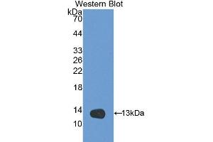 Western Blotting (WB) image for anti-Serpin Peptidase Inhibitor, Clade G (C1 Inhibitor), Member 1 (SERPING1) (AA 406-476) antibody (ABIN3208983) (SERPING1 Antikörper  (AA 406-476))