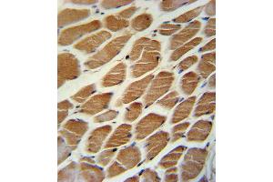 ACADL Antibody immunohistochemistry analysis in formalin fixed and paraffin embedded human skeletal muscle followed by peroxidase conjugation of the secondary antibody and DAB staining. (ACADL Antikörper  (AA 292-319))