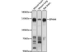Western blot analysis of extracts of various cell lines, using EPH antibody (ABIN6132064, ABIN6140215, ABIN6140216 and ABIN6224369) at 1:1000 dilution. (EPH Receptor A4 Antikörper  (AA 887-986))