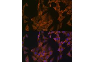 Immunofluorescence analysis of NIH-3T3 cells using Zyxin Rabbit mAb (ABIN1682627, ABIN3015962, ABIN3015963 and ABIN7101467) at dilution of 1:100 (40x lens). (ZYX Antikörper)
