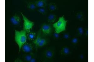 Anti-BUB1B mouse monoclonal antibody (ABIN2452850) immunofluorescent staining of COS7 cells transiently transfected by pCMV6-ENTRY BUB1B (RC205844). (BUB1B Antikörper)