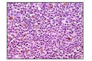 Immunohistochemical analysis of paraffin-embedded human lymphnode tissues using MCL1 mouse mAb with DAB staining. (MCL-1 Antikörper)