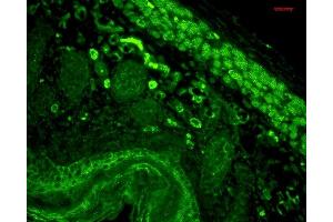 Immunohistochemistry analysis using Mouse Anti-CD74 Monoclonal Antibody, Clone PIN 1. (CD74 Antikörper)