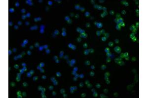 Immunofluorescence staining of Jurkat cells with ABIN7148445 at 1:166, counter-stained with DAPI.