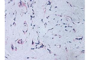 Image no. 2 for anti-Platelet Factor 4 (PF4) antibody (ABIN465152) (PF4 Antikörper)