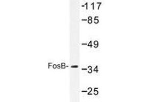 Western blot analyzes of FosB antibody in extracts from COS7 cells. (FOSB Antikörper)