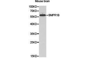 Western Blotting (WB) image for anti-Bone Morphogenetic Protein Receptor, Type IB (BMPR1B) antibody (ABIN1871327)