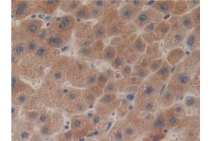 IHC-P analysis of Human Liver Tissue, with DAB staining. (LCAT Antikörper  (AA 41-210))