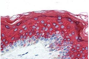 Human Skin (formalin-fixed, paraffin-embedded) stained with KRT10 antibody ABIN364279 at 10 ug/ml followed by biotinylated anti-mouse IgG secondary antibody ABIN481714, alkaline phosphatase-streptavidin and chromogen. (Keratin 10 Antikörper)